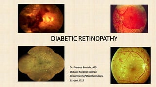 Dr. Pradeep Bastola, MD
Chitwan Medical College,
Department of Ophthalmology,
22 April 2022
DIABETIC RETINOPATHY
 