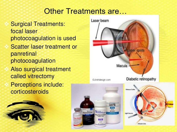 Treatment for diabetic retinopathy