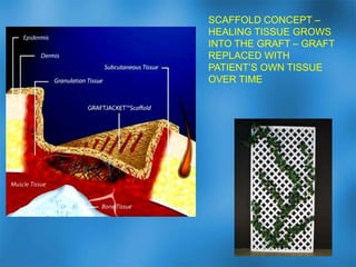 Surgical procedures -AmputationsConsiderations in amputation selection levelVascular supply- Is it adequate for healing?- Is the patient a candidate for revascularization?Consider how the limb and patient will functionNonambulatory patients may be better served with a more proximal amputation Patients with otherwise impaired isolated limb function  need individualized consideration Dropfoot		Flexion ContracturePreservation of as much of a functional limb as possible.- Decreased cardiac workloadPlan bone and soft tissue resection and closure carefully to prevent further problems25