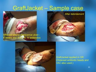 Advanced treatments and products26