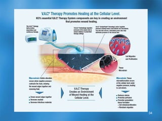 New surgical products - scaffoldsGraftJacket, AllodermFreeze-dried human dermis 