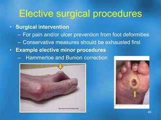 Selection of appropriate advanced therapyHow can the healing process be best enhanced for the ulcer?Applying medical expertise and judgment to each situation Medicine is often more an art than a science. Know what each product can do – particular indications and benefits of each device or treatment.Are there any reasons why advanced treatments cannot be used in the situation?38