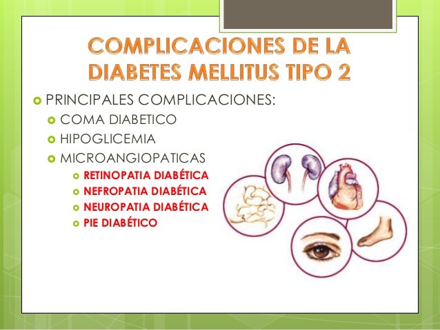 Diabetimss Diabetimss