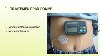 “
”
TRAITEMENT PAR POMPE
 Pompe externe sous cutanée
 Pompe implantable
 