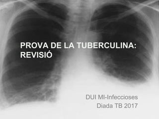 PROVA DE LA TUBERCULINA:
REVISIÓ
DUI MI-Infeccioses
Diada TB 2017
 