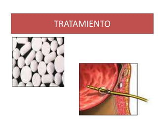 Disminución de los ruidos respiratorios