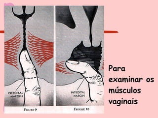 Para examinar os músculos vaginais 