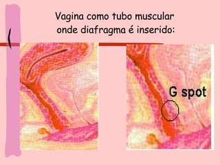 Vagina como tubo muscular  onde diafragma é inserido: 
