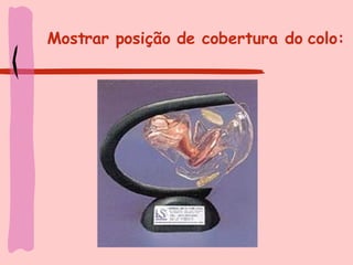 Mostrar posição de cobertura do colo: 