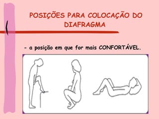 POSIÇÕES PARA COLOCAÇÃO DO DIAFRAGMA   - a posição em que for mais CONFORTÁVEL.  