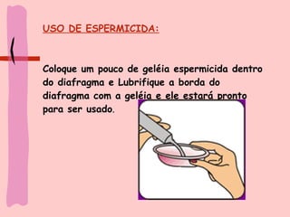 USO DE ESPERMICIDA: Coloque um pouco de geléia espermicida dentro do diafragma e Lubrifique a borda do diafragma com a geléia e ele estará pronto para ser usado .   