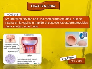 82% - 94%
Aro metálico flexible con una membrana de látex, que se
inserta en la vagina e impide el paso de los espermatozoides
hacia el útero en el coito
¿Qué es?
 