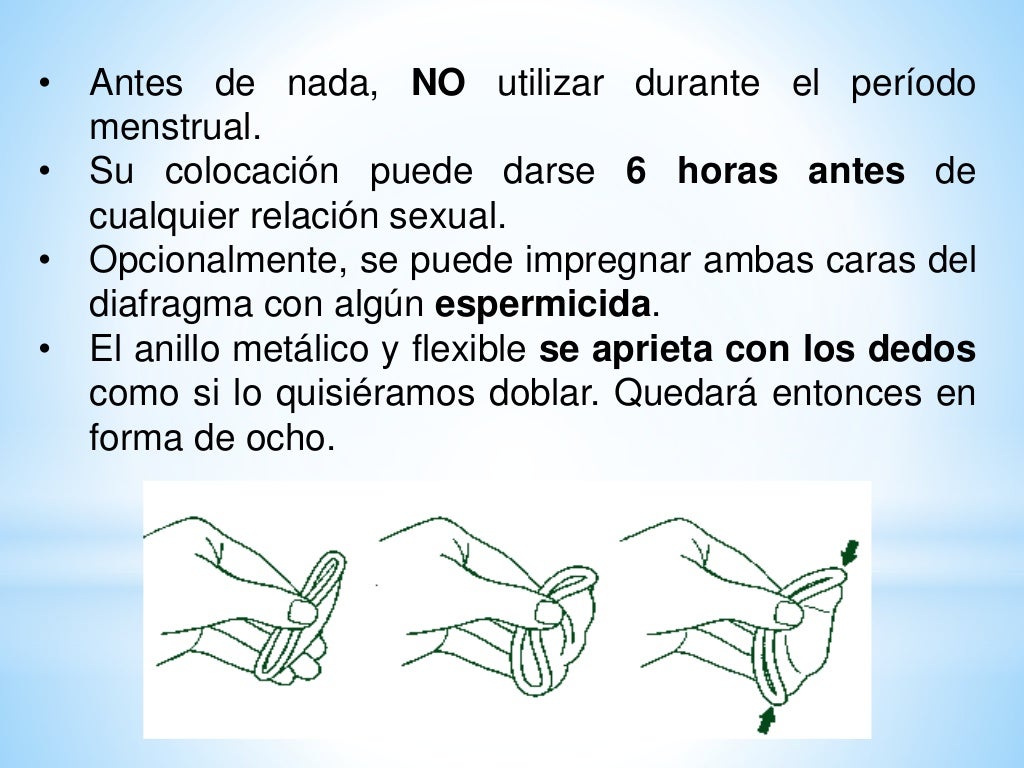 Diafragma Metodo Anticonceptivo