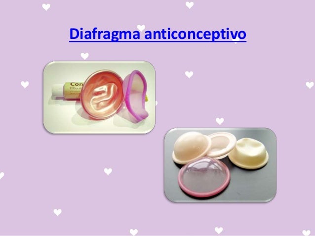 diafragma-anticonceptivo-c-mo-funciona