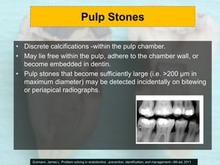Pulp Stone On Bitewing CLINICAL DIAGNOSIS OF ENDODONTIC PATHOSIS | PPT