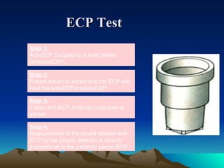 String Ecp Test Diagnoisis of allergy in children | PPT