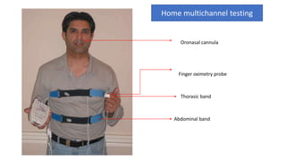 Oronasal cannula
Thorasic band
Abdominal band
Finger oximetry probe
Home multichannel testing
 