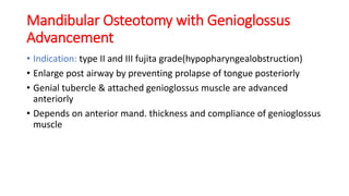 Mandibular Osteotomy with Genioglossus
Advancement
• Indication: type II and III fujita grade(hypopharyngealobstruction)
• Enlarge post airway by preventing prolapse of tongue posteriorly
• Genial tubercle & attached genioglossus muscle are advanced
anteriorly
• Depends on anterior mand. thickness and compliance of genioglossus
muscle
 