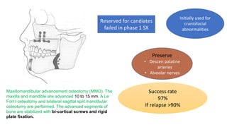 Maxillomandibular advancement osteotomy (MMO). The
maxilla and mandible are advanced 10 to 15 mm. A Le
Fort I osteotomy and bilateral sagittal split mandibular
osteotomy are performed. The advanced segments of
bone are stabilized with bi-cortical screws and rigid
plate fixation.
Reserved for candiates
failed in phase 1 SX
Initially used for
craniofacial
abnormalities
Preserve
• Descen palatine
arteries
• Alveolar nerves
Success rate
97%
If relapse >90%
 