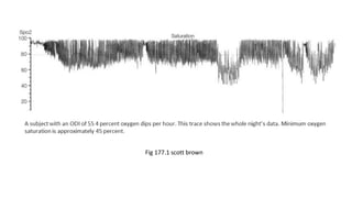 Fig 177.1 scott brown
 
