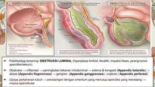 Diagnosa dan Tatalaksana Appendicitis Akut | PPTX