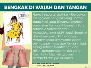 BENGKAK DI WAJAH DAN TANGAN
Hampir separuh dari ibu – ibu aakan
mengalami bengkak yang normal
pada kaki yang biasanya muncul
pada sore hari dan biasanya hilang
setelah beristirahat atau
meletakkannya lebih tinggi. Bengkak
dapat menjunjukkan adanya
masalah serius jika muncul pada
permukaan muka dan tangan, tidak
hilang setelah beristirahat, dan
diikuti dengan keluhan fisik yang
lain. Hal ini bisa merupakan
pertanda dari pre eklamsia
AKADEMI KEBIDANAN YASPEN
TUGU IBU CIBUBUR
 