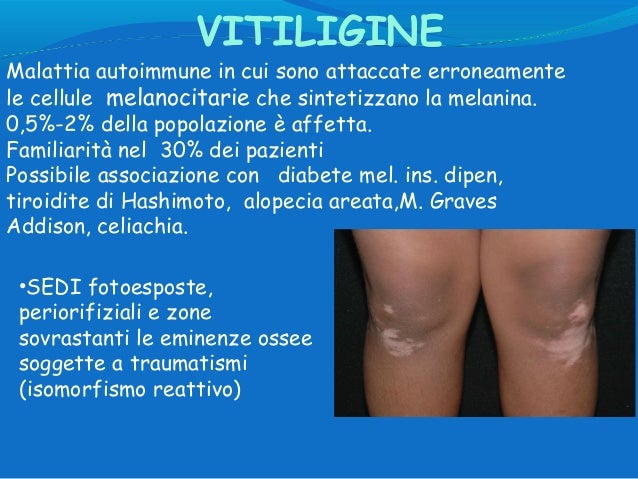 Prova di eczema del sito web