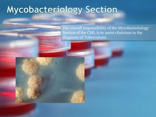 The overall responsibility of the Mycobacteriology
Section of the CML is to assist clinicians in the
diagnosis of Toberculosis.
 