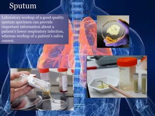 Sputum
Laboratory workup of a good quality
sputum specimen can provide
important information about a
patient’s lower respiratory infection,
whereas workup of a patient’s saliva
cannot.
 