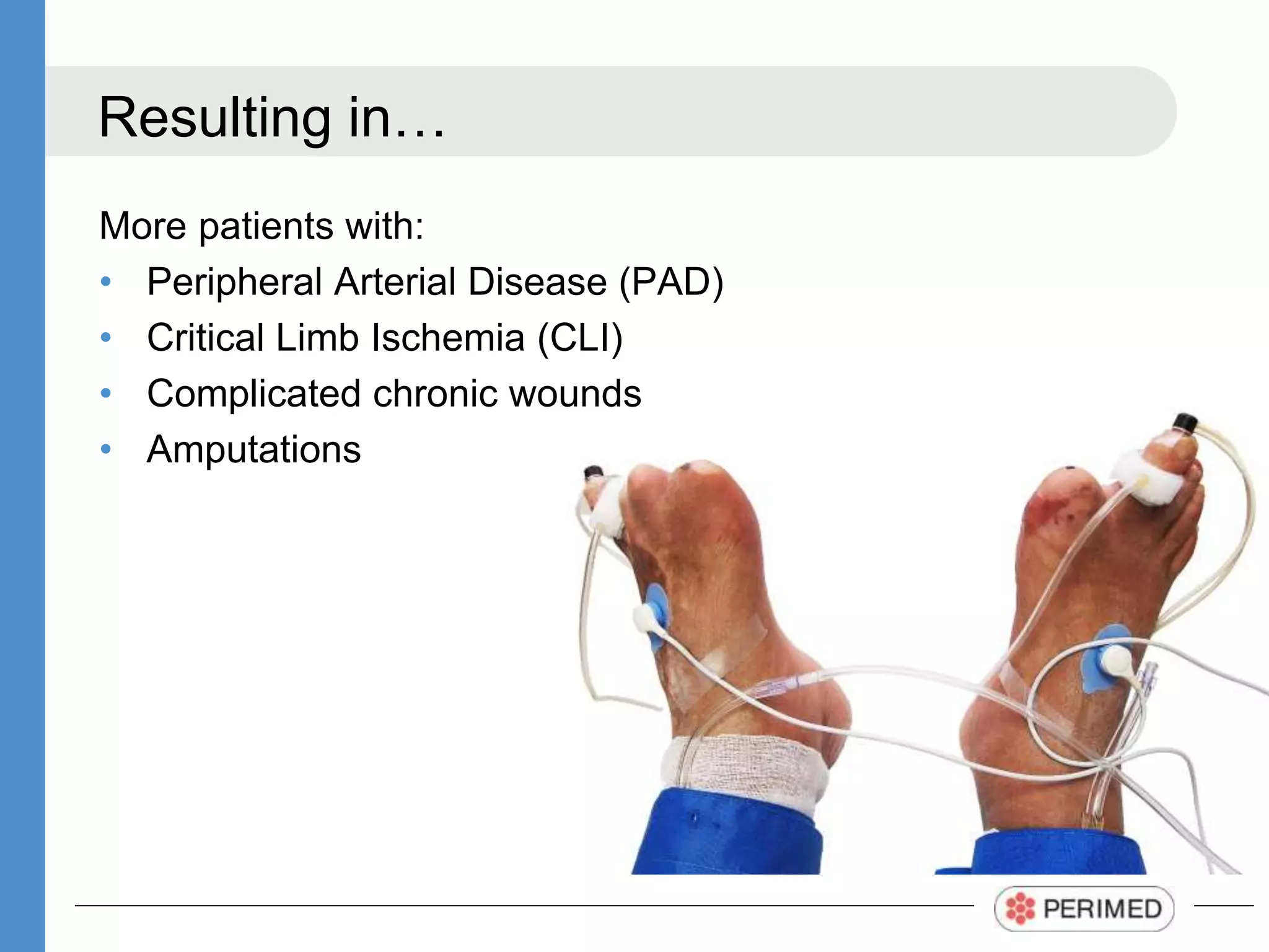 Diagnosing peripheral arterial disease and assessing degree of ischemia ...