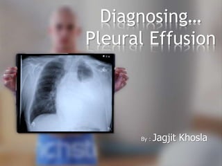 Diagnosing…
Pleural Effusion
By : Jagjit Khosla
 