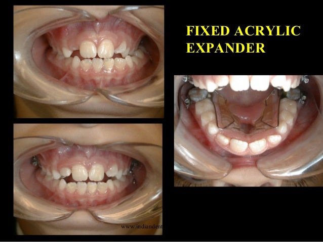 diagnosis define the problem certified fixed orthodontic courses by i