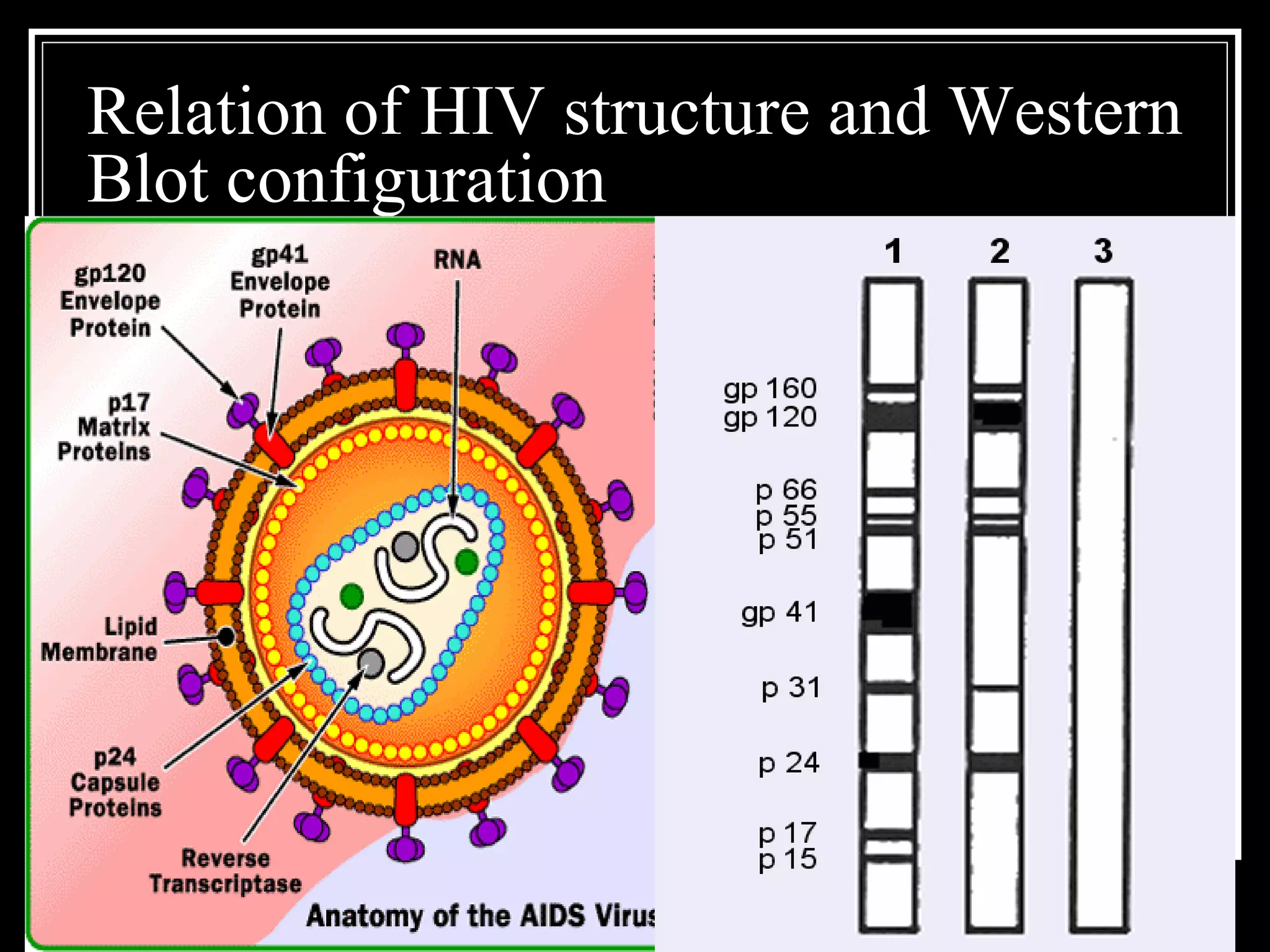 Diagnosis of-aids | PDF