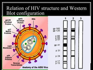 Relation of HIV structure and Western
Blot configuration
 