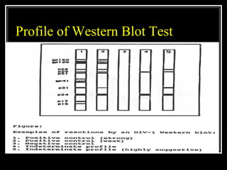 Profile of Western Blot Test
 