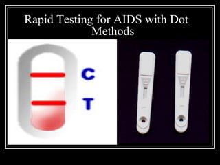 Diagnosis of-aids | PDF