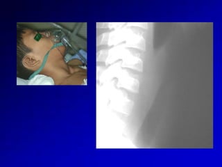 Diagnosis-of-ent-disorders-you-make-the-call.pptx