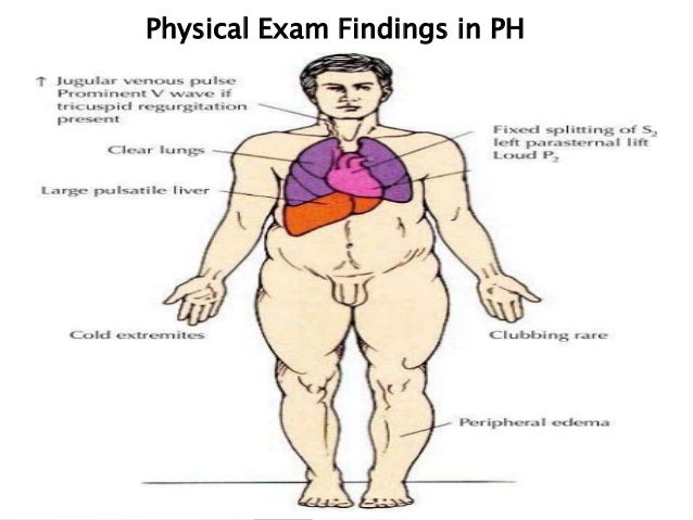 Pulmonary hypertension and breathlessness