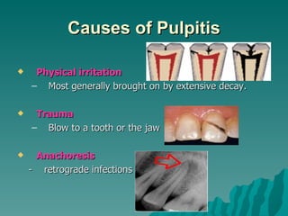 Causes of Pulpitis

    Physical irritation
    – Most generally brought on by extensive decay.

    Trauma
    – Blow to a tooth or the jaw

    Anachoresis
    - retrograde infections
 