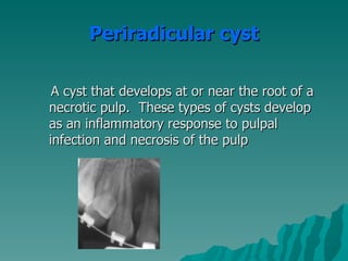 Periradicular cyst

 A cyst that develops at or near the root of a
necrotic pulp. These types of cysts develop
as an inflammatory response to pulpal
infection and necrosis of the pulp
 