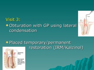 Visit 3:
 Obturation with GP using lateral
  condensation

 Placed   temporary/permanent
             restoration (IRM/Kalzinol)
 