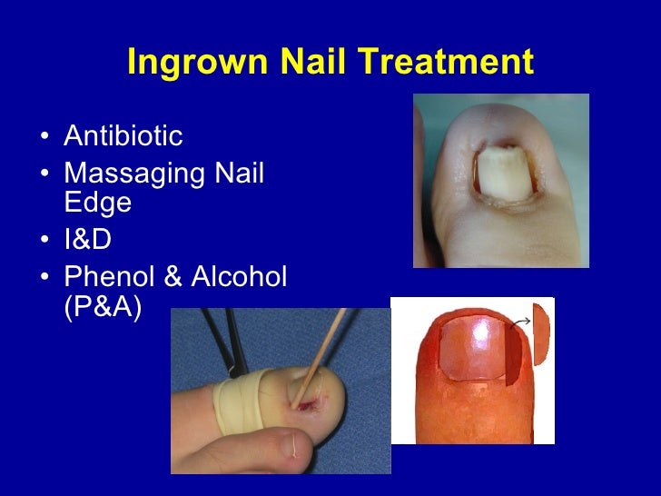 Diagnosis and management by PCPs of simple podiatric problems