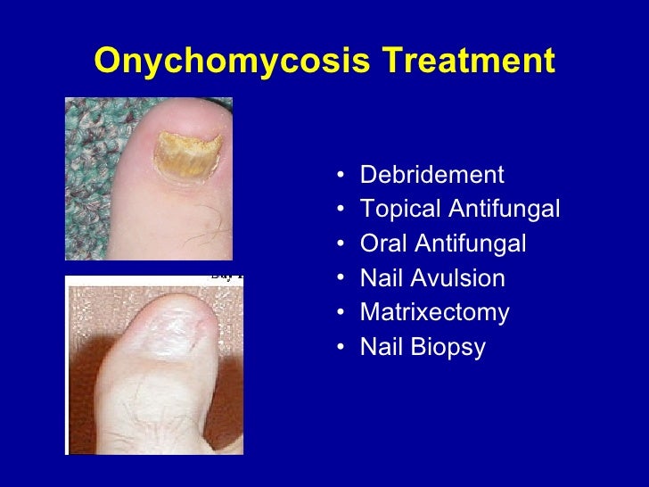 Diagnosis and management by PCPs of simple podiatric problems
