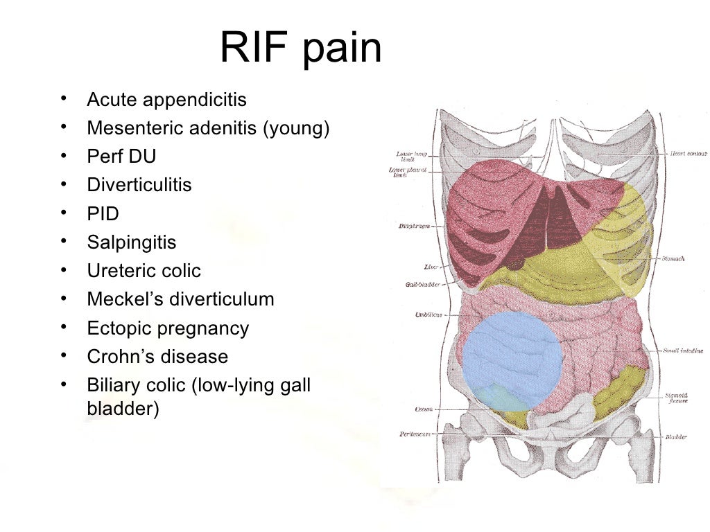 Diagnosis And Management Of Acute Abdominal Pain