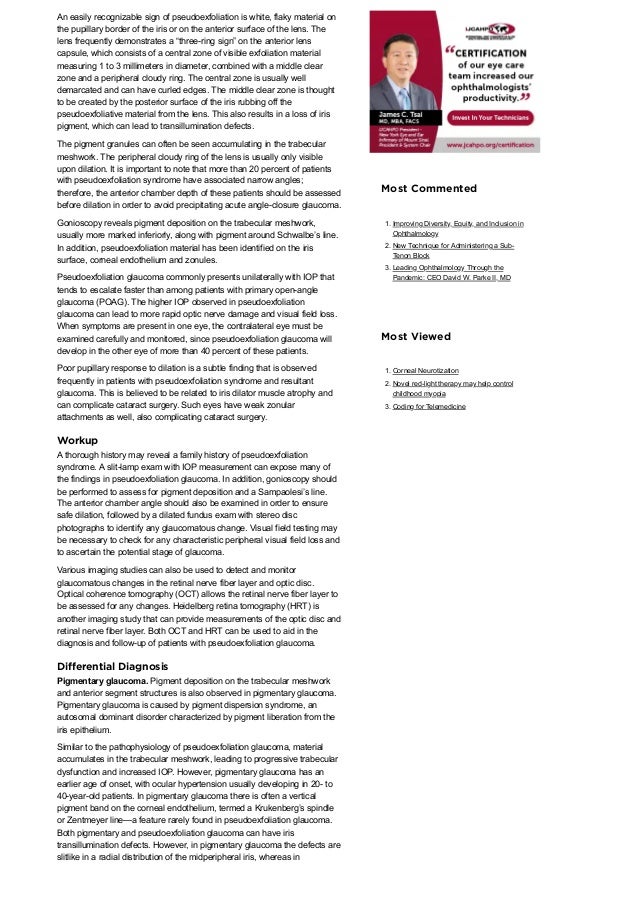 Diagnosis and Management of Pseudoexfoliation Glaucoma - American ...