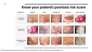 Diagnosis and Management of Psoriasis- August Psoriasis Awareness Month ...