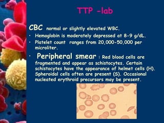 Diagnosis and management of thombocytopenic disorders | PPT