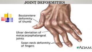 JOINT DEFORMITIES
 