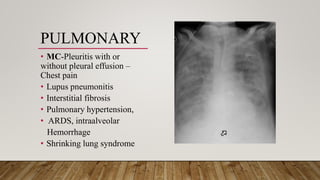 PULMONARY
• MC-Pleuritis with or
without pleural effusion –
Chest pain
• Lupus pneumonitis
• Interstitial fibrosis
• Pulmonary hypertension,
• ARDS, intraalveolar
Hemorrhage
• Shrinking lung syndrome
 