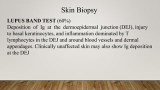Skin Biopsy
LUPUS BAND TEST (60%)
Deposition of Ig at the dermoepidermal junction (DEJ), injury
to basal keratinocytes, and inflammation dominated by T
lymphocytes in the DEJ and around blood vessels and dermal
appendages. Clinically unaffected skin may also show Ig deposition
at the DEJ
 